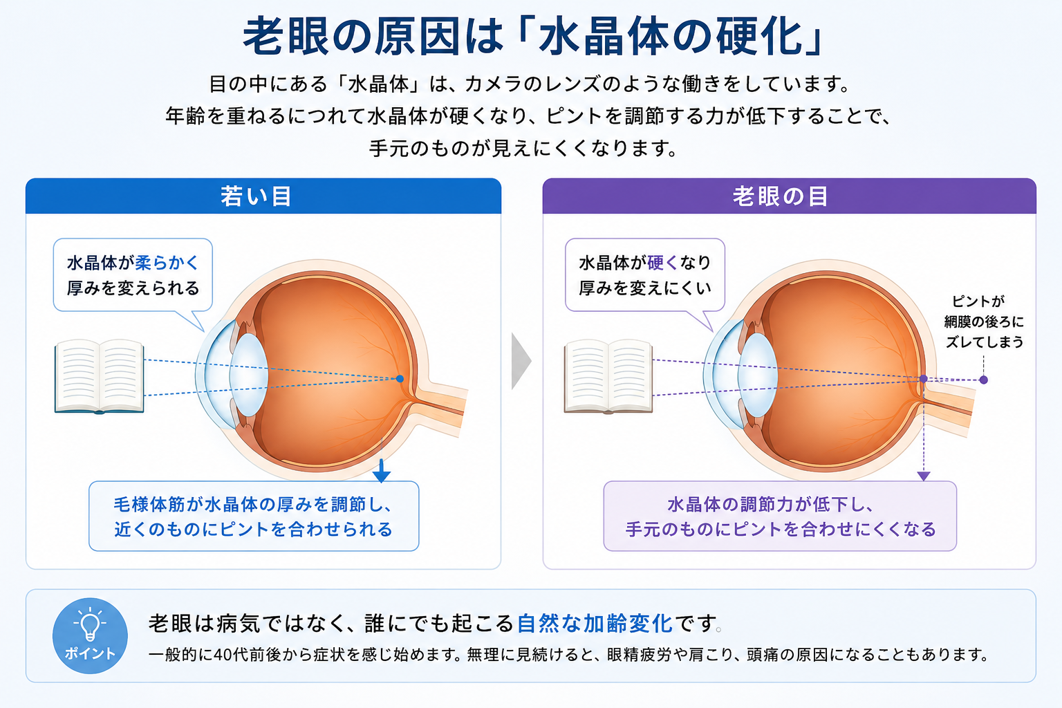 若い目と老眼の目を比較した図解